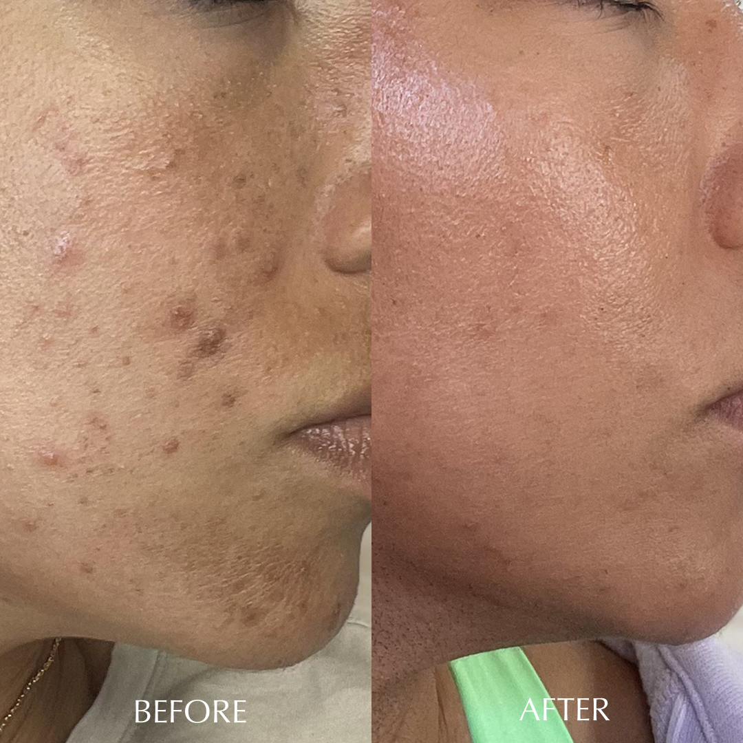 REJUVENATION DUO