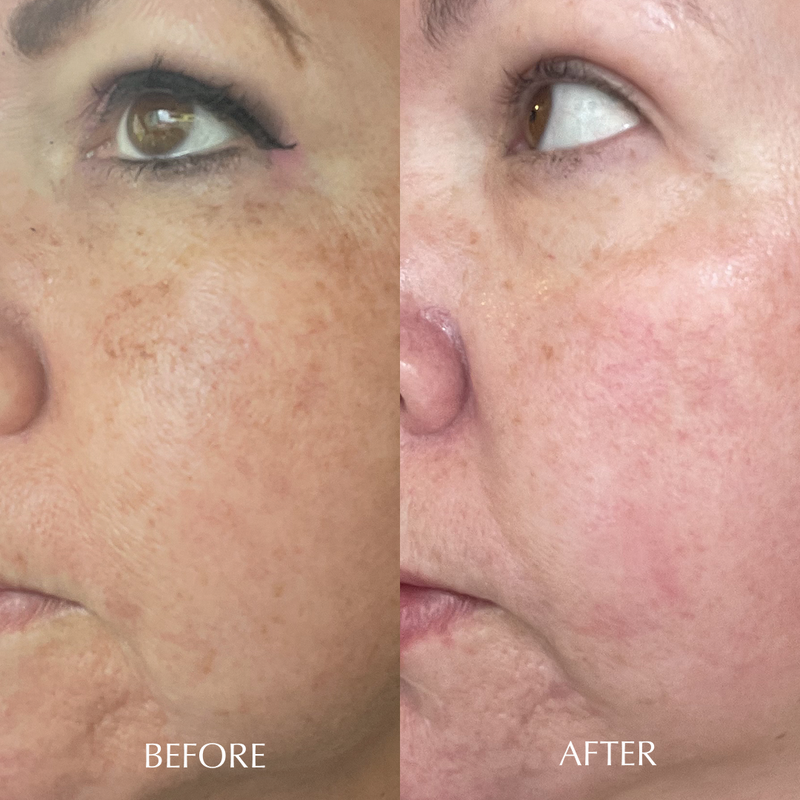 EGF HEALING CREAM